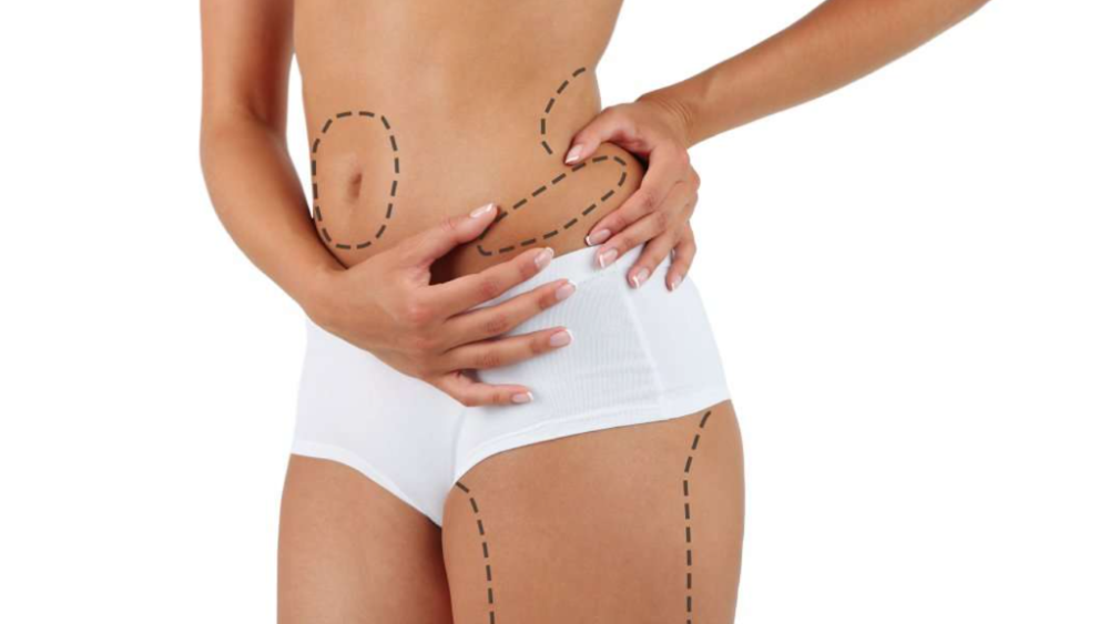What are the benefits of liposuction?