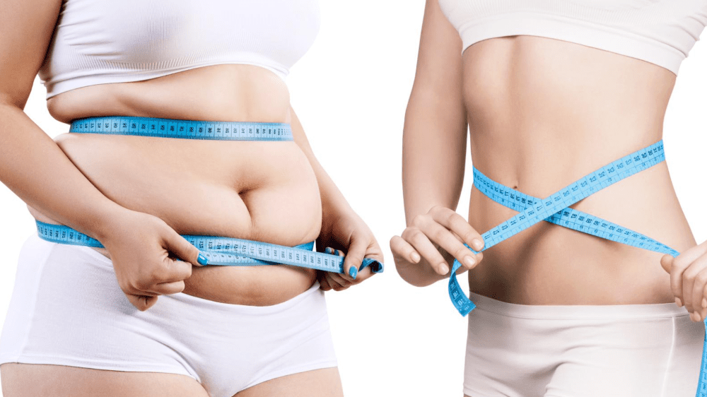 What kind of results should be expected after the liposuction?