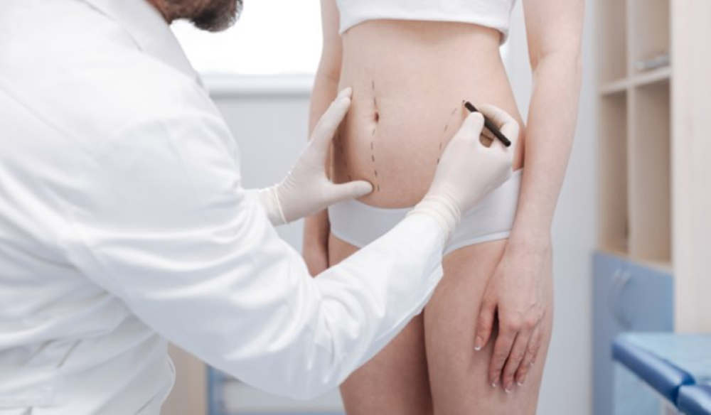 Where is liposuction can be performed?